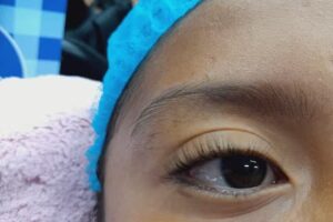 Estética nueva imagen