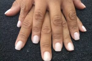 GRISDAN est&eacute;tica