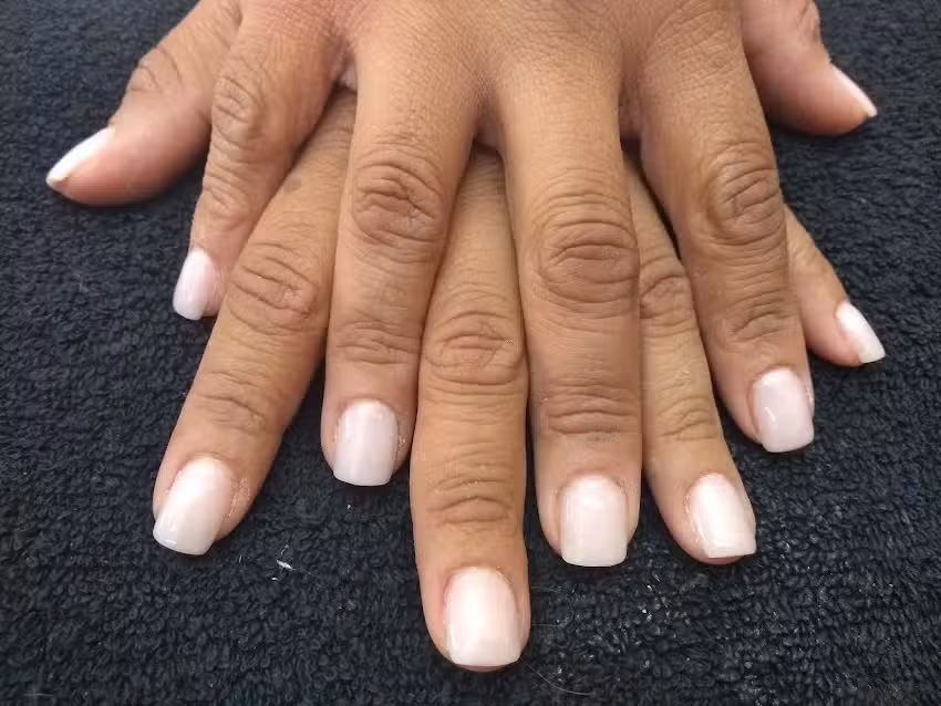 GRISDAN est&eacute;tica