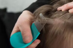 Kutu Especialistas en Pediculosis